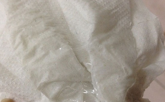 果纳芬是一种重组人促卵泡激素