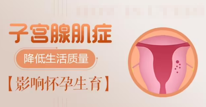 子宫腺肌症会影响怀孕