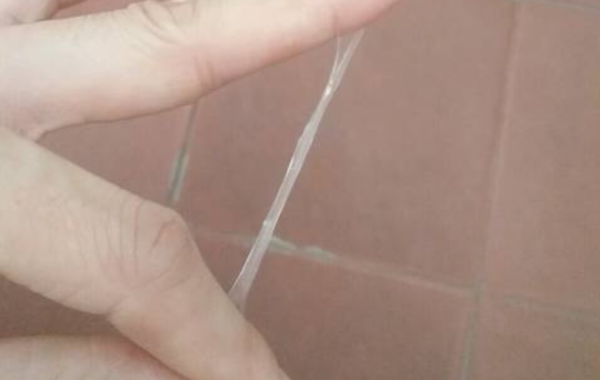 白带拉丝最长可以长达10cm左右