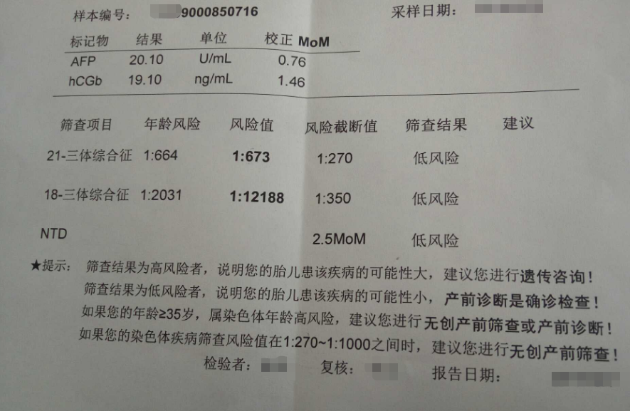 唐氏筛查报告单