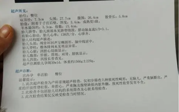 通过小排畸检查可以判断染色体是否异常