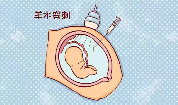 孕妇做完羊水穿刺第5天就感染了怎么办？
