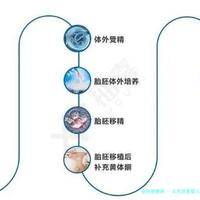北京试管婴儿流程分享_北京试管婴儿多少钱一次?！