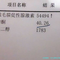为什么要制定试管方案？短方案促排流程揭秘！促排过程解析！2024版