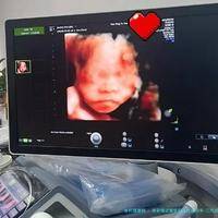 西安做试管医院三代成功率-三代试管儿西安赴美生子！