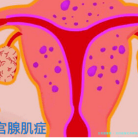 下一篇