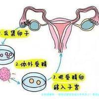 泰国试管宝宝成功率有多少！泰国试管成功率比国内高吗！