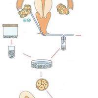 2025太原试管婴儿费用有哪些？费用可以用医保报销吗？