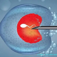 乌克兰试管婴儿费用揭秘：低花费达十五万，选孩子新体验费用几何？开端2024年行情分析