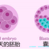 促排卵方案中的超长方案适合什么样的人群?