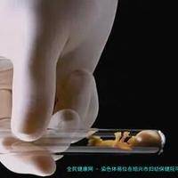 染色体易位在绍兴市妇幼保健院可以做三代试管吗？染色体平衡易位还能生健康的宝宝吗？