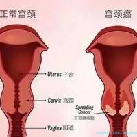 试管婴儿双*胎费用是多少？2025年最全试管婴儿费用构成与省钱建议！