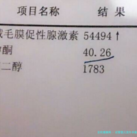试管婴儿宫外孕是什么？宫外孕后有哪些解决办法？试管婴儿降低宫外孕风险的方法有哪些？