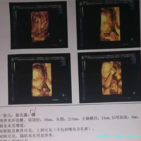 石家庄试管婴儿医院大全？石家庄试管婴儿成功率医院排名？