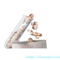 在国内可以做试管婴儿3吗(在国内做试管婴儿可以生孩子吗)