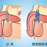 益阳第三代试管费用详单解析(益阳试管婴儿医院排名)