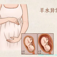 上一篇