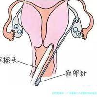 下一篇