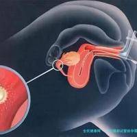 2025助孕试管助孕需要什么条件？助孕做试管单周期的收费是多少钱