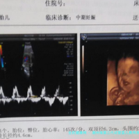 潮州做第三代试管婴儿费用高吗！费用多少呢？