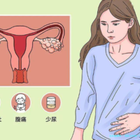高龄女性做广州第三代试管婴儿会更好！实例费用解读！