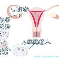 重庆三代试管生孩子是真的吗？在重庆做试管可行吗？