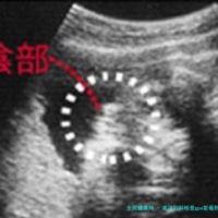 谁说妇科检查gpa能看到生育史了，目前已经辟谣要注意