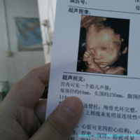 北医三院试管婴儿攻略公布：生殖科挂号方法一次说清楚