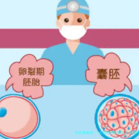 试管移植后能马上走路吗？怀生健康生殖中心专业解析与最新建议