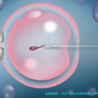 2025广州私立机构试管婴儿花费明细表一览？