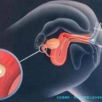 上一篇