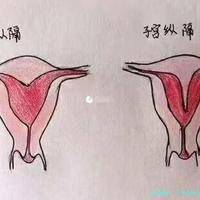 下一篇