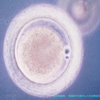 上一篇