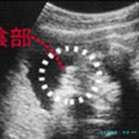 怀孕 ***  *** 的症状_怀 *** 的症状-试管文章