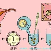 试管婴儿费用多少？武汉做试管婴儿全流程费用揭秘