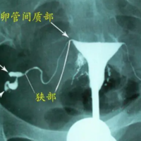 上一篇