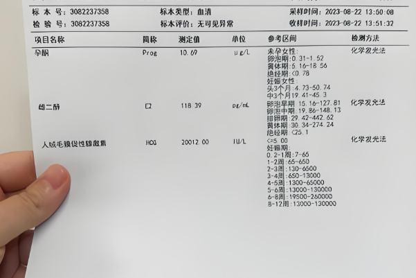 双胎hcg要比单胎更高