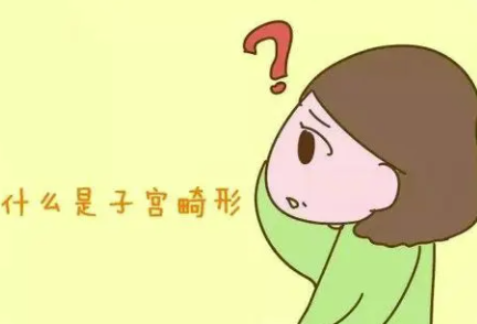 女性子宫畸形
