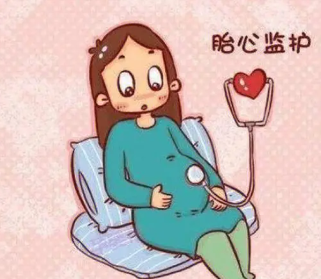 孕晚期第二次去做胎心监护要想过关要注意哪三个点？