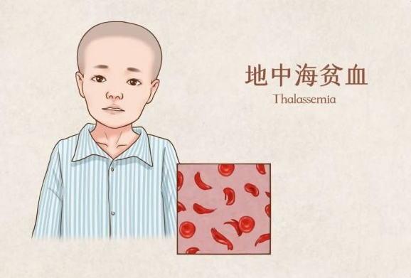 轻度地贫可能无明显症状