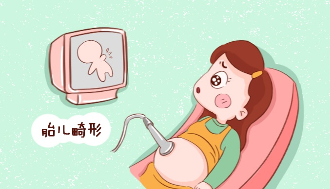 高龄女性容易怀畸形胎儿