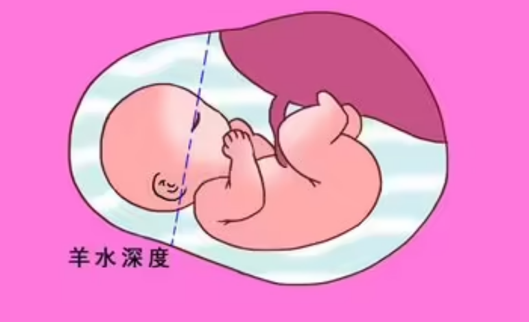 孕妇整个孕期的羊水深度mm对照表