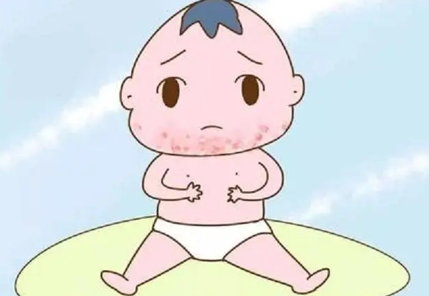 火棉胶婴儿是一种罕见的遗传病