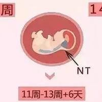 上一篇
