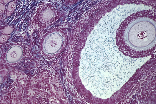 年龄越大基础卵泡数量越少