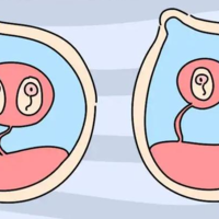 35岁以上可以做试管婴儿怀双*胎吗？