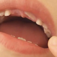 上一篇