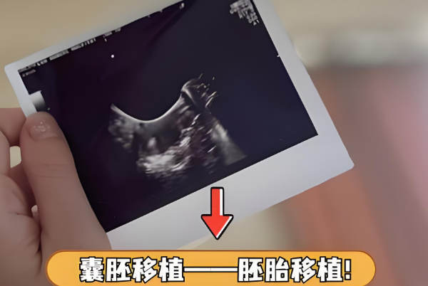 囊胚移植时间会影响着床率