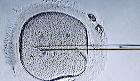试管8细胞二级能养囊能成功