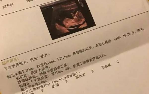 怀了男宝报告单上不会出现特点